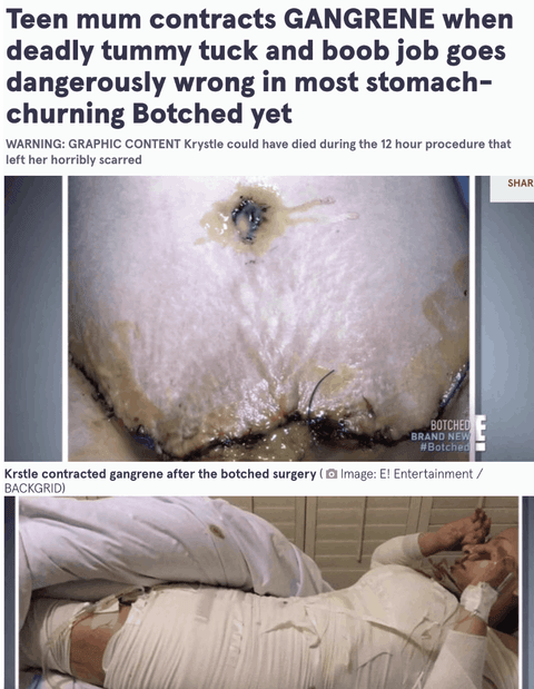 Imagen del artículo «Medicina hiperbárica en medicina estética y cirugía plástica»