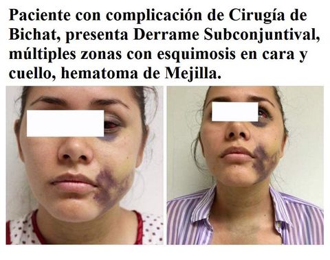 Imagen del artículo «Medicina hiperbárica en medicina estética y cirugía plástica»